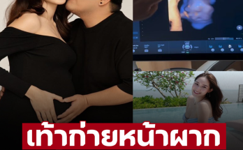 ‘แจ็ค แฟนฉัน’ เปิดคลิป ‘น้องคากิ’ เอาเท้าก่ายหน้าผาก ก่อนได้รับคำตอบหมอ