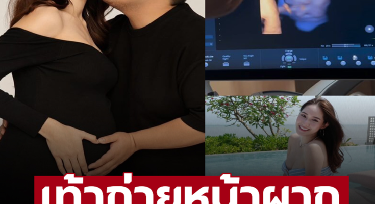 ‘แจ็ค แฟนฉัน’ เปิดคลิป ‘น้องคากิ’ เอาเท้าก่ายหน้าผาก ก่อนได้รับคำตอบหมอ