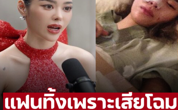 “ไอซ์ ปรีชญา” รู้ตัวว่าผิดปกติหลังเกิดอุบัติเหตุ หนำซ้ำแฟนทิ้งหลังบอกอาจจะเสียโฉม