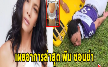 เผยอาการล่าสุด พิม ซอนย่า เกิดอุบัติเหตุตกม้า และถูกม้าเหยียบซ้ำ